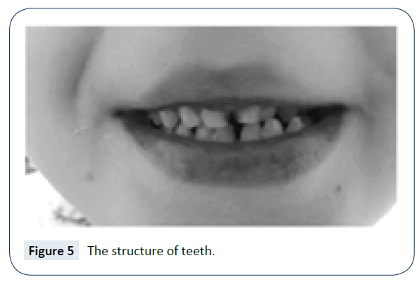 rare-disorders-diagnosis-therapy-structure-teeth