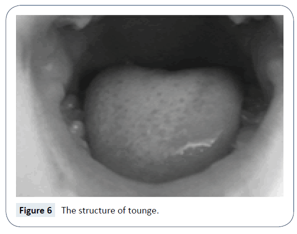 rare-disorders-diagnosis-therapy-structure-tounge