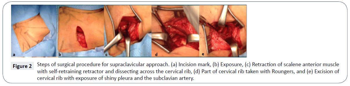 Oral And Maxillofacial Surgery