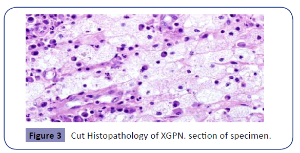 raredisorders-Cut-Histopathology