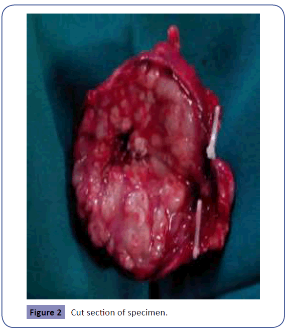 raredisorders-Cut-section-specimen