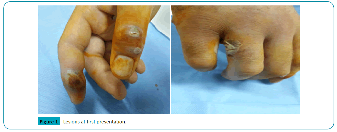 raredisorders-Lesions-first-presentation