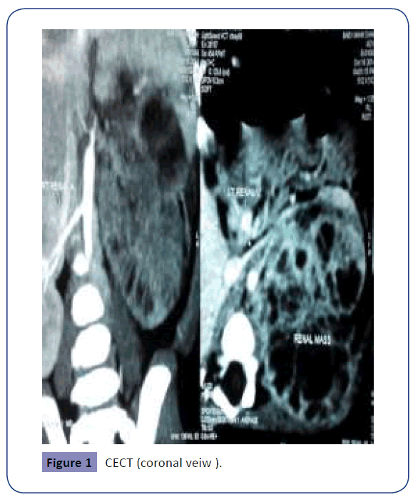 raredisorders-coronal-veiw