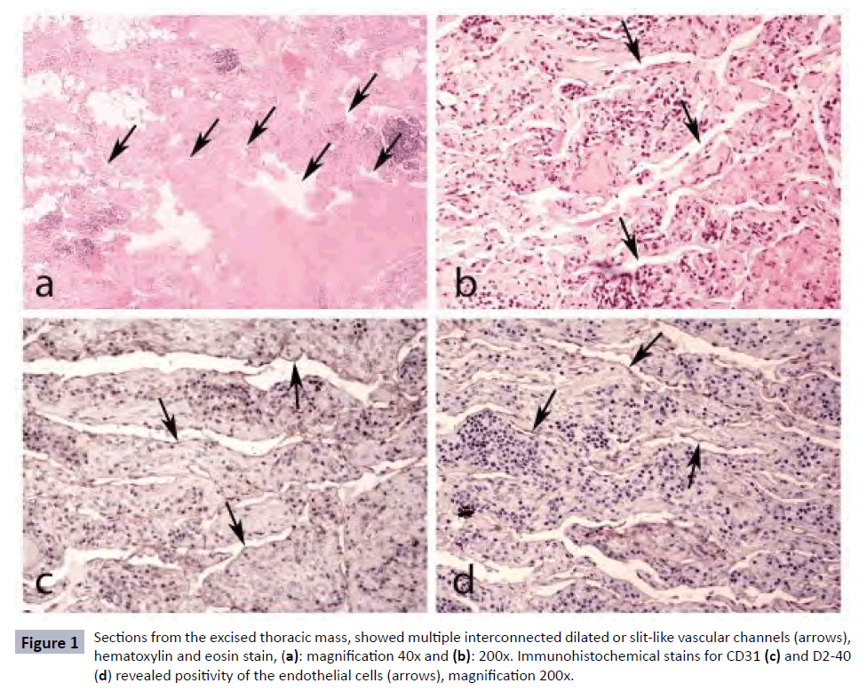 raredisorders-vascular-channels